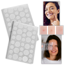 Load image into Gallery viewer, Confezione da 36 cerotti invisibili per l'acne - Ozerty