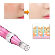 Load image into Gallery viewer, Penna per micro-needling dermico - Ozerty