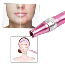 Load image into Gallery viewer, Penna per micro-needling dermico - Ozerty