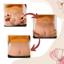 Load image into Gallery viewer, Massaggiatore per cellulite a vibrazione ad alta frequenza - Ozerty