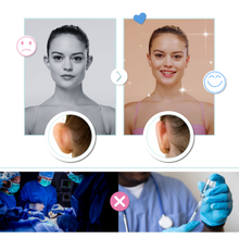 Load image into Gallery viewer, Linguette Invisibili per le Orecchie - Ozerty