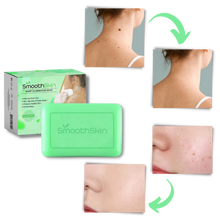 Load image into Gallery viewer, Esfoliante idratante Sapone per la rimozione delle verruche - Ozerty