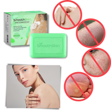 Load image into Gallery viewer, Esfoliante idratante Sapone per la rimozione delle verruche - Ozerty