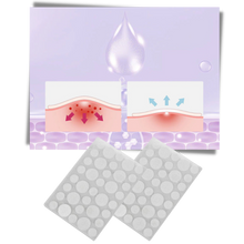 Load image into Gallery viewer, Confezione da 36 cerotti invisibili per l'acne - Ozerty
