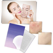 Load image into Gallery viewer, Confezione da 36 cerotti invisibili per l'acne - Ozerty
