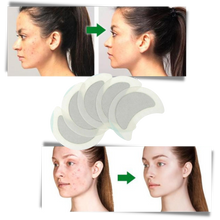 Carica l'immagine nel visualizzatore di Gallery, 5 x Cerotti a base di erbe antisudore
