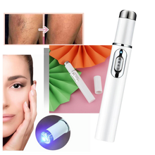 Load image into Gallery viewer, Penna per la terapia della pelle a luce blu - Ozerty

