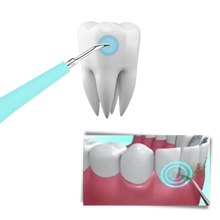 Load image into Gallery viewer, Macchina per la pulizia profonda del tartaro dei denti - Ozerty

