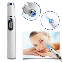 Load image into Gallery viewer, Penna laser blu per la rimozione delle macchie scure - Ozerty
