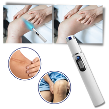 Load image into Gallery viewer, Penna laser blu per la rimozione delle macchie scure - Ozerty
