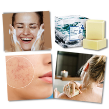 Load image into Gallery viewer, Sapone antiacne naturale al sale marino - Ozerty
