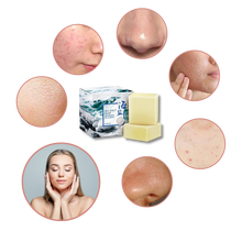 Load image into Gallery viewer, Sapone antiacne naturale al sale marino - Ozerty
