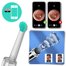 Load image into Gallery viewer, Telecamera intelligente per la rimozione del cerume dall'orecchio - Ozerty
